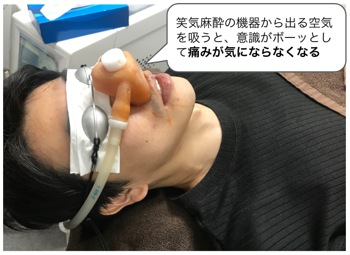 ゴリラクリニックのヒゲ脱毛｜医療レーザーの痛みはどのくらい？痛みの強さや麻酔の効果など徹底解説