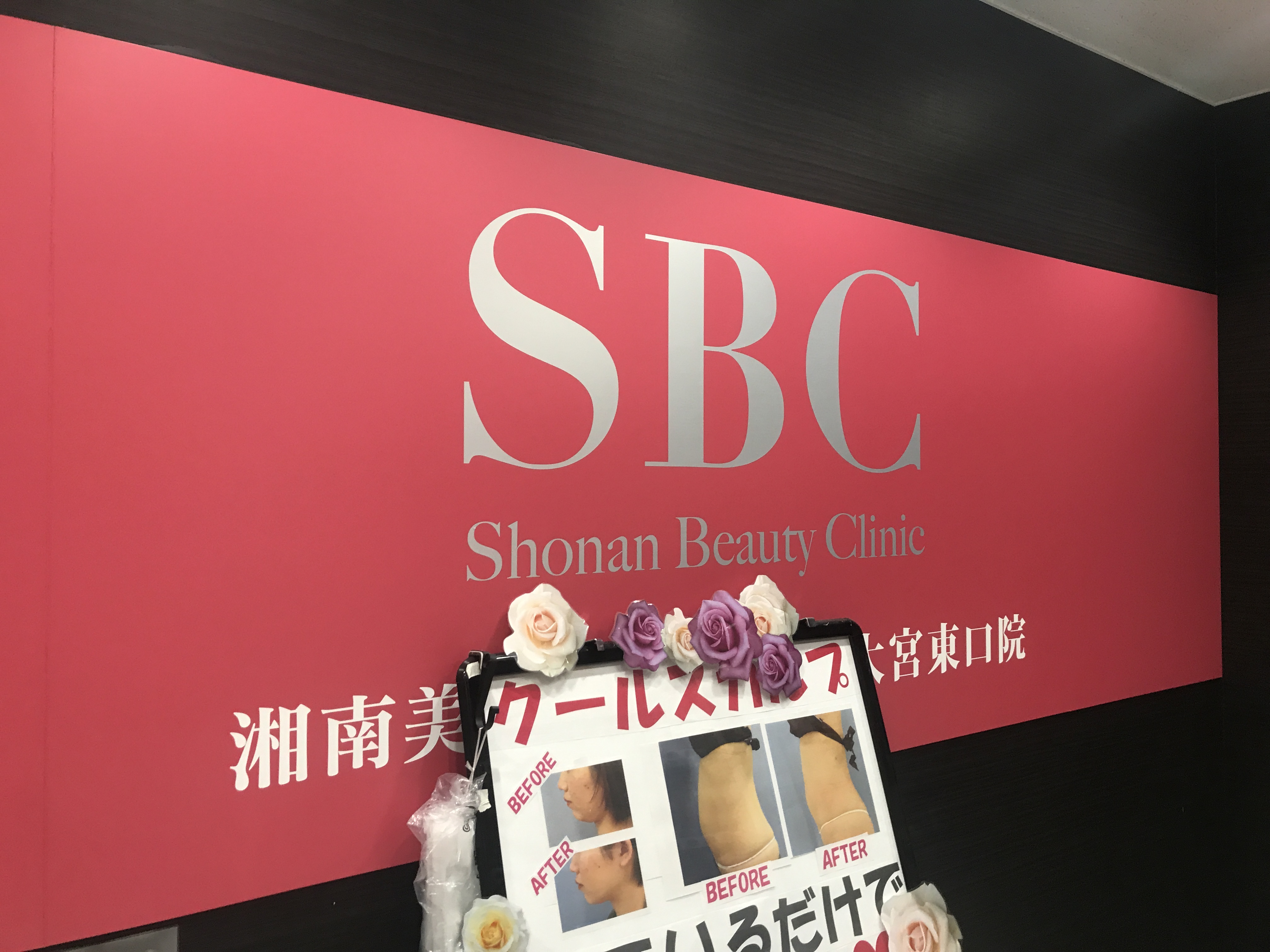 メンズ脱毛：脇の体験脱毛で一番安いのはどのクリニック！？結論、湘南美容クリニック一択です。